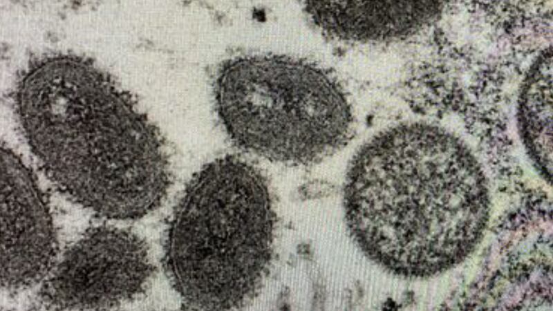 Microscopic slide of Monkey Pox