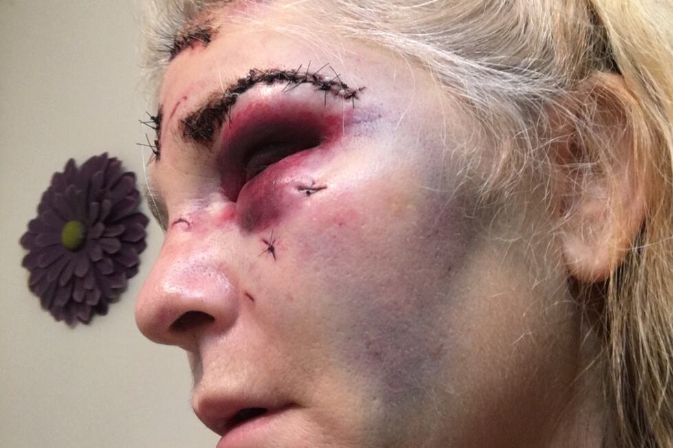 Elizabeth Easton was assaulted Wednesday by an inmate.